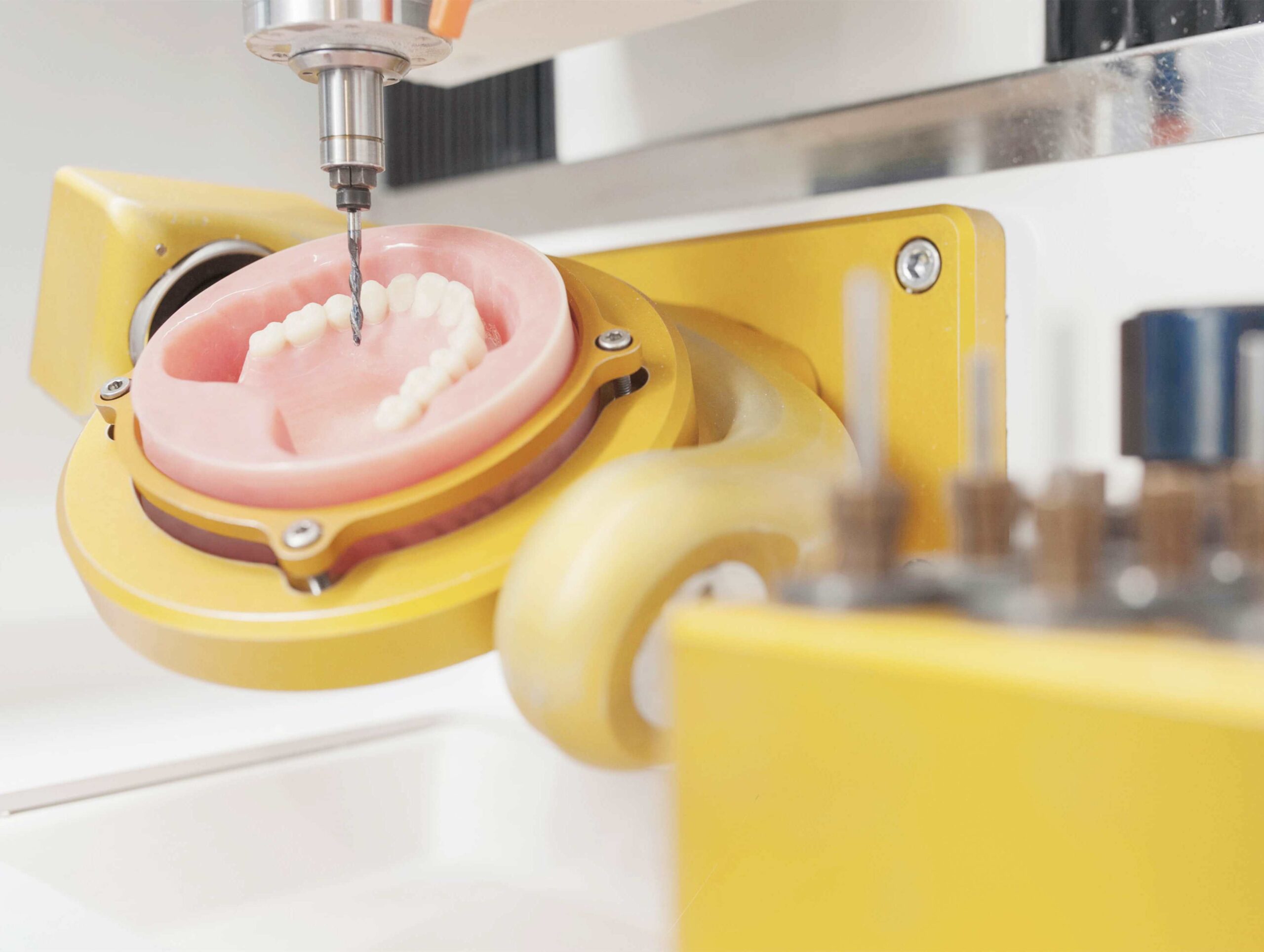 CAD CAM Dentistry dental pmma prosthesis