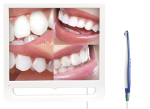 4 picture display camera intraoral dental equipment with screen
