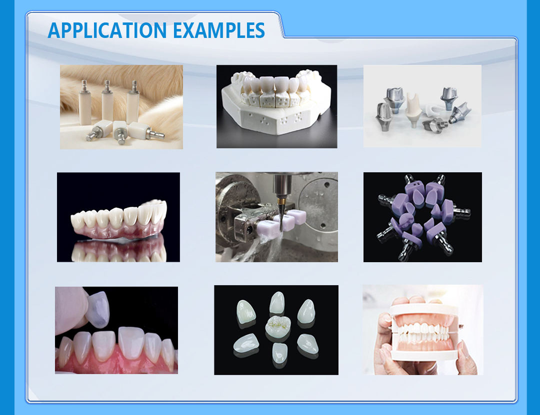 wet milling application from veneer to abutment